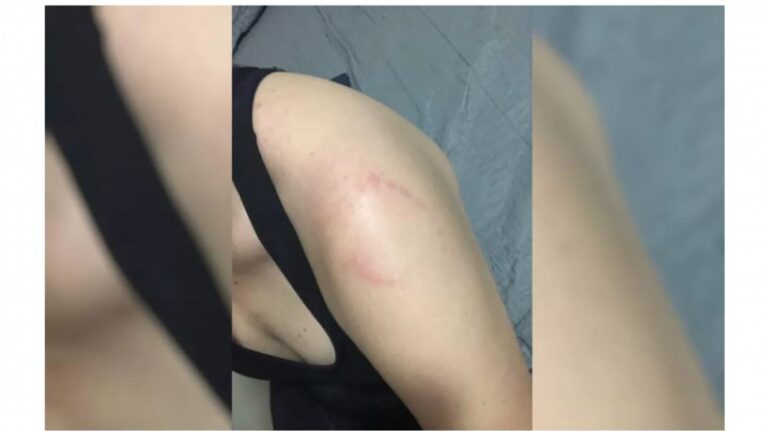 Homem morde mulher em academia