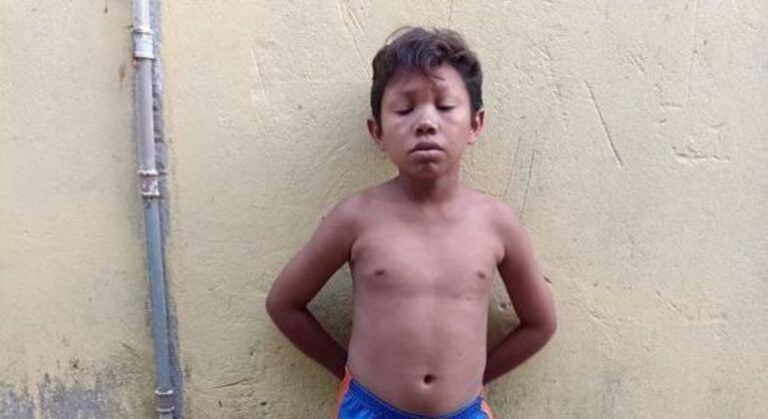 MOLEQUINHO | Jovem de 20 anos com aparência de criança é morto a tiros