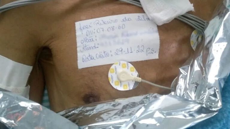 Hospital diz que homem morreu e funerária encontra ele acordado