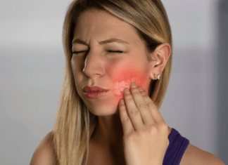 Dor de dente siso: Aliviando o incômodo da dor