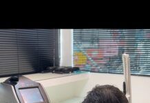 Empresa desenvolve máquina portátil de remoção de tatuagem