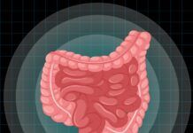 Câncer de intestino: a detecção precoce é fundamental para o tratamento e a cura