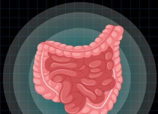 Câncer de intestino: a detecção precoce é fundamental para o tratamento e a cura