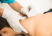 Benefícios da acupuntura na Odontologia