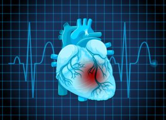 Cardiologista orienta sobre cuidados após o infarto