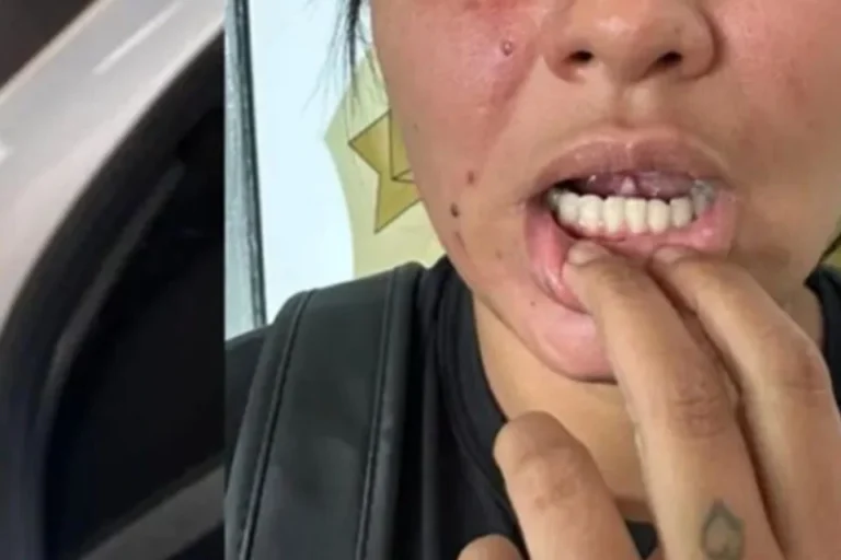 POLÍCIA: Homem corta língua da esposa com uma faca