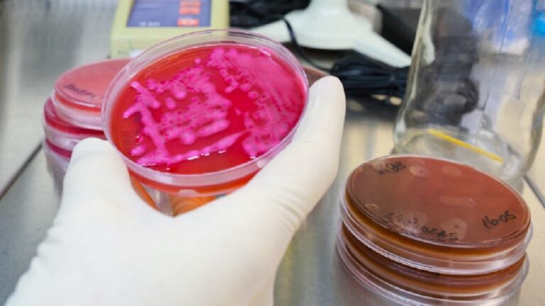 Enchentes no RS: Mais de 800 casos suspeitos de leptospirose. o Estado havia contabilizado quatro casos de mortes.