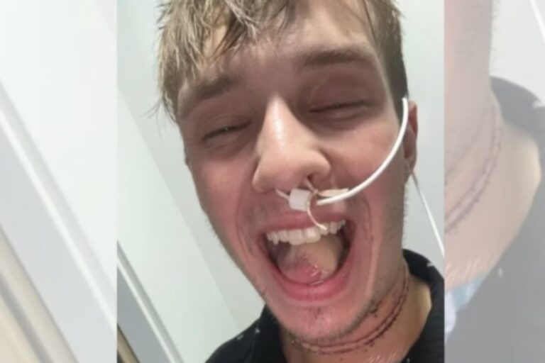 Jovem descobre câncer de pele após morder a língua. O câncer era um tipo de carcinoma agressivo, que ele nem havia percebido.