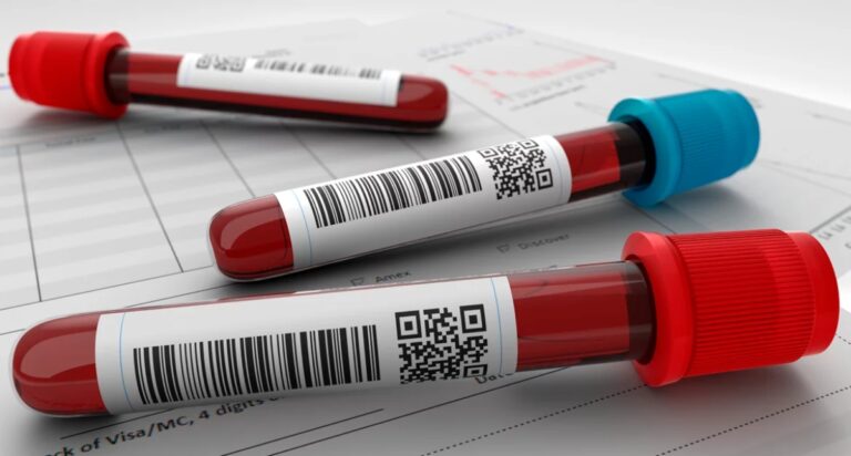 Homem pode ter sido infectado pela doença da vaca louca