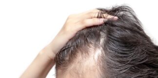 Dicas de como evitar a queda de cabelo