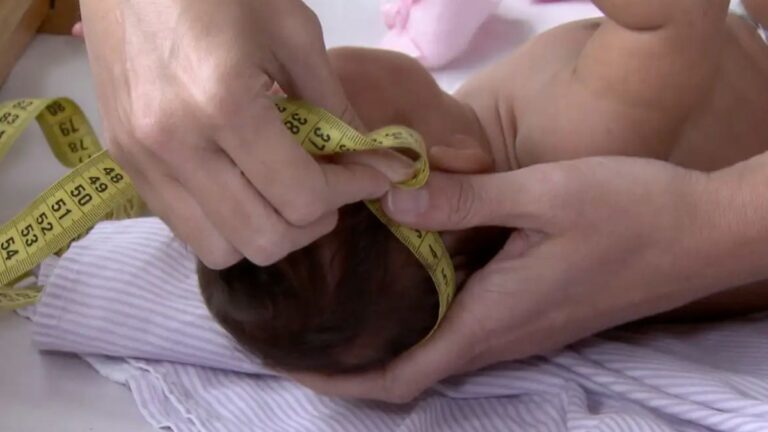 Auxílio Zika de R$60 mil