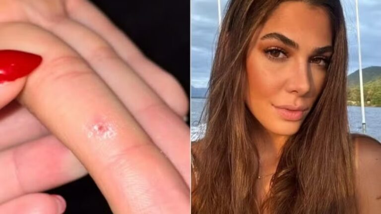 Estudante afirma ter contraído HPV durante treino em academia