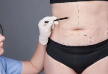 Cirurgia bariátrica peso