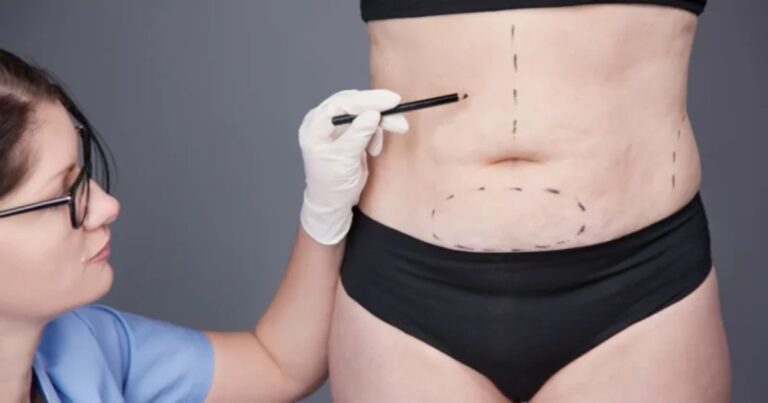 Cirurgia bariátrica peso