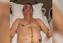 Bolsonaro posta foto com intestino à mostra antes de cirurgia