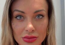 "OREM POR MIM!" Andressa Urach faz cirurgia para mudar a cor dos olhos e enfrenta complicações