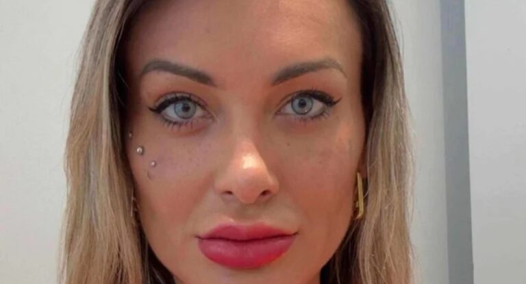 "OREM POR MIM!" Andressa Urach faz cirurgia para mudar a cor dos olhos e enfrenta complicações