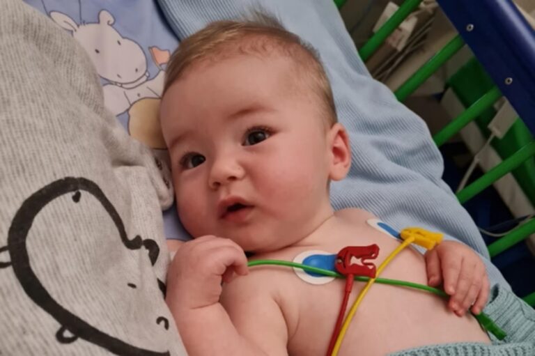 bebê dano cerebral vírus