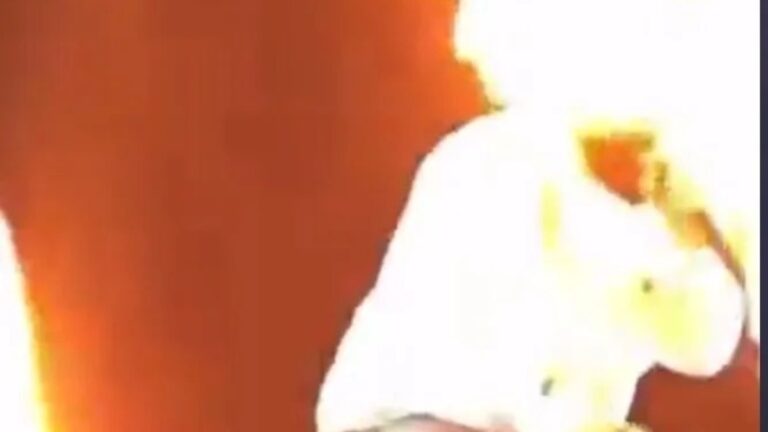 cantor sertanejo queimaduras