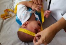 Indenização Zika Vírus: veja quem recebe R$ 60 mil de benefício