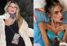 Influenciadora que pesava 22kg morre aos 30 anos