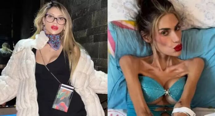 Influenciadora que pesava 22kg morre aos 30 anos