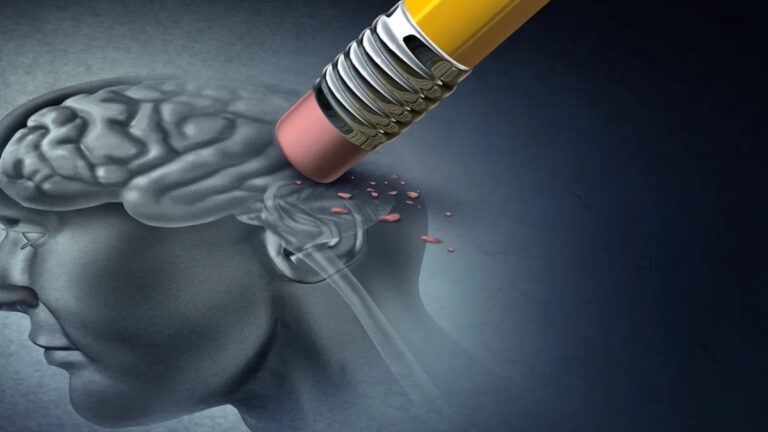 Foto que representa o Alzheimer