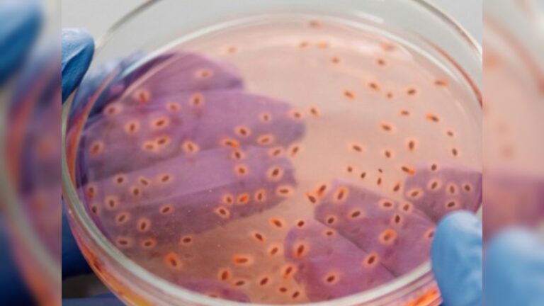 Bactéria que causou pandemia