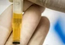 Pode parecer estranho, mas é verdade: cientistas estão usando xixi humano para criar materiais utilizados em implantes dentários e ósseos