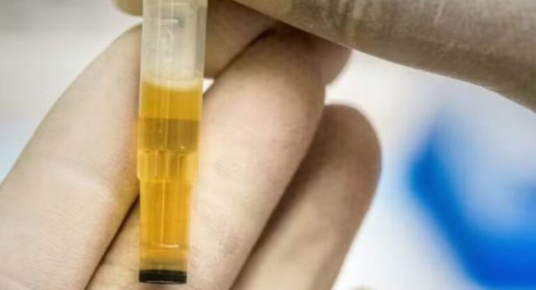 Pode parecer estranho, mas é verdade: cientistas estão usando xixi humano para criar materiais utilizados em implantes dentários e ósseos