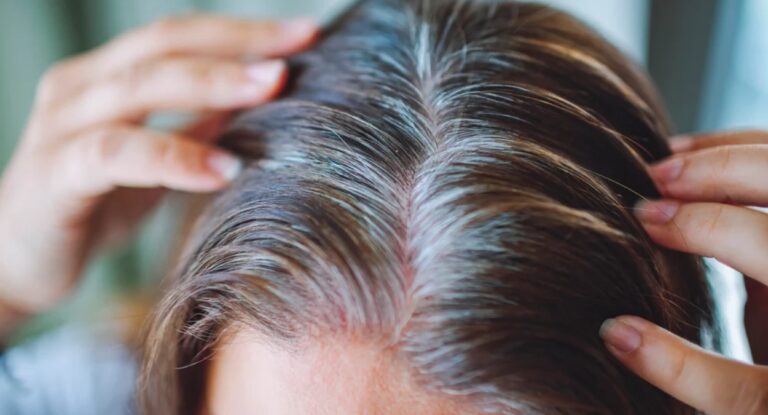 Couro cabeludo de uma mulher