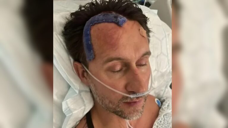 Na foto, o homem que tinha sintomas de enxaqueca, mas descobriu que era um cãncer