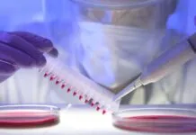 Imagem mostra cientista analisando cromossomos da síndrome de down