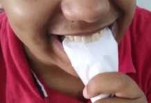 foto de uma pessoa com síndrome de pica