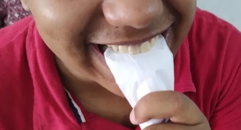 foto de uma pessoa com síndrome de pica