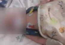 foto do bebê de dois meses espancado pelos pais em imbé