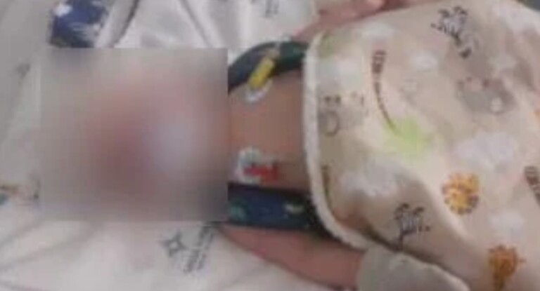 foto do bebê de dois meses espancado pelos pais em imbé