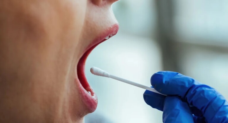 foto ilustra o estudo feito com as bactérias da boca