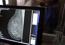 foto de exame de mamografia