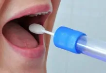 foto de um teste de saliva que pode ajudar a diagnosticar a depressão de forma mais rápida.
