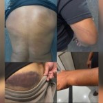 VÍDEO: ex-Internacional, Perdigão, é agredido por policial na saída de jogo