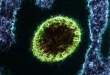 Conheça o vírus Nipah, doença cerebral que pode causar nova pandemia Conheça o vírus Nipah, doença cerebral que pode causar nova pandemia