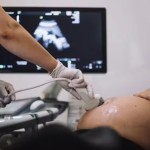 Superfecundação heteropaternal: entenda a condição que levou mulher a ter filhos de pais diferentes ao mesmo tempo