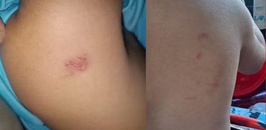 Professora é afastada após mãe esconder gravador em mochila do filho e registrar maus-tratos em creche