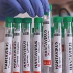 Hantavírus pode começar como gripe e evoluir rapidamente para falta de ar grave; veja todos os sintomas e fique atento