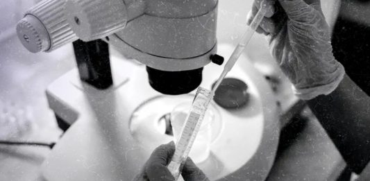 Cientistas conseguem feito histórico e removem cromossomo extra da síndrome de Down pela primeira vez Cientistas conseguem feito histórico e removem cromossomo extra da síndrome de Down pela primeira vez